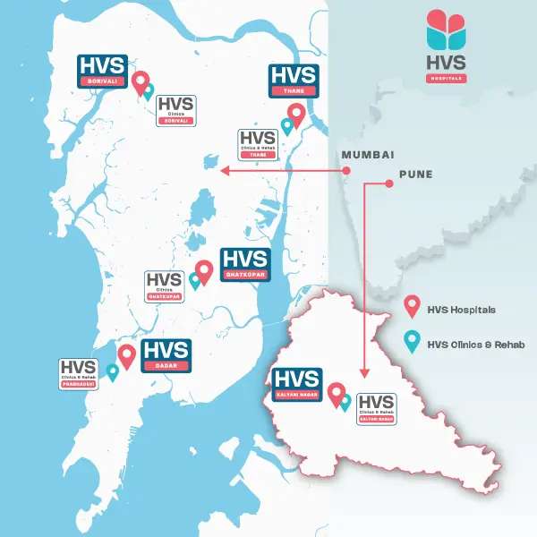 HVS HomepageBanner Mobile New