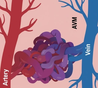 Arterial Malfunction